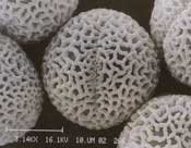 Highly allergenic pollen grains from an Olive tree